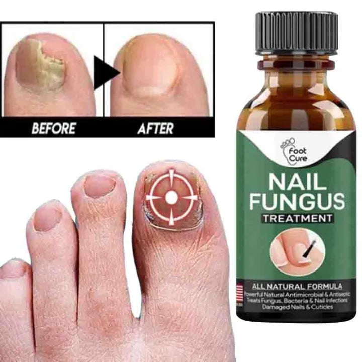 Anti Fungal Nail Repair Serum