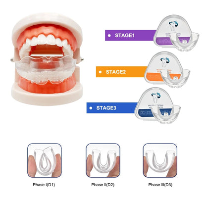 Teeth Alignment & Jawline Mouth Retainer