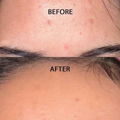 Nightly Exfoliating Treatment - Wake Up to Smoother, Clearer-Looking Skin