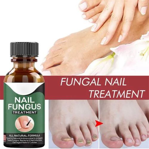 Anti Fungal Nail Repair Serum