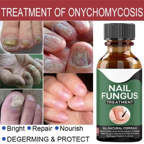 Anti Fungal Nail Repair Serum