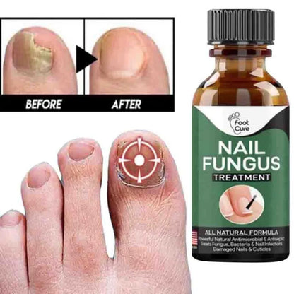 Anti Fungal Nail Repair Serum